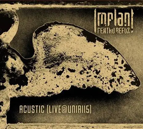 Implant Pentru Refuz : Acustic (Live@Unirii5)